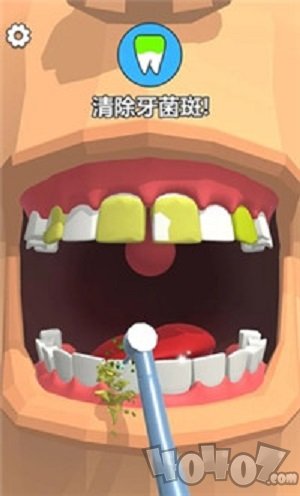 洗牙