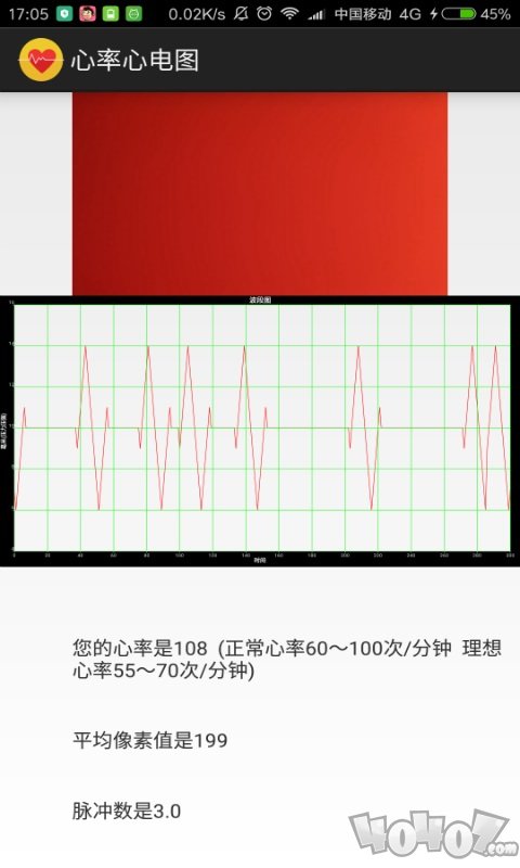 心率心电图
