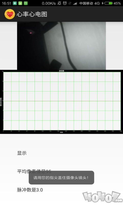 心率心电图