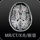 影像学图谱