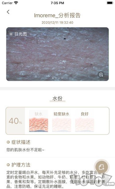 MoreMe水肤镜